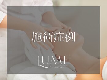 ルーミー 南青山(LUME)/当店の人気メニューの症例写真