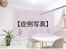 ルミリア(Lumiria)/Before|After