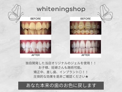ホワイトニングショップ 三田店の写真