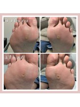 巻き爪補正店 大阪なんば店/たこ・魚の目