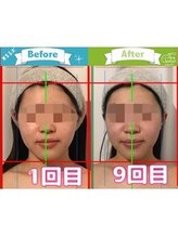 小顔整体研究所 KSラボ 新潟中山店/