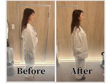整体ラルース 中目黒(LALUZ)/20代 女性 ストレートネック改善
