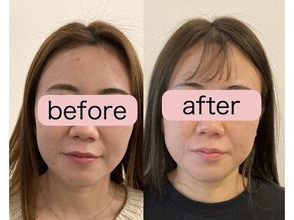 ルク ソル(Luxsol)の写真