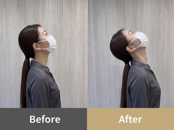 整体クオーレ 奈良新大宮店(Cuore)/Before After