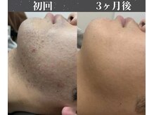 ジェントル 福岡天神店(GENTLE)の雰囲気(脱毛は当たり前!肌の徹底管理まで本物のプロが管理)