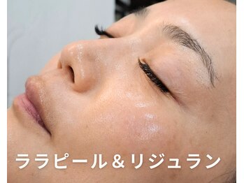 アイオンラッシュ(Aion Lash)/ララピールとリジュラン