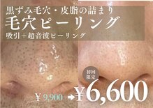 アルト(ALTO)