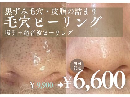 アルト(ALTO)の写真