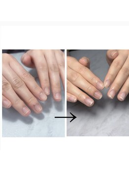 シフォンネイル(Shifon.nail_)の写真/【爪育成/クリアネイル¥5000(税込】爪の悩み解消!深爪にお悩みの方にも♪美爪へ導きます♪
