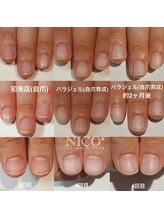 ニコプラス(NICO+)/自爪育成パラジェルクリア補強