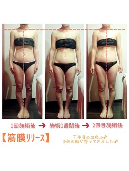 ビューティサロン キヨの部屋(beauty salon)/【筋膜リリース】 ２回の変化