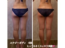 ルポーゼ(Repose)/