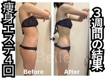 ベル 南船場店(Belle)/痩身エステ4回