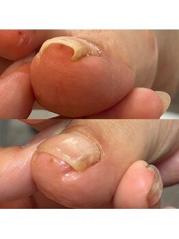 ウェルズユキ(well's yuki)/