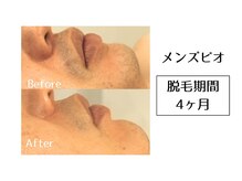 メンズビオ 神戸三宮店/