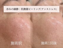 ラシュール(Rassure)
