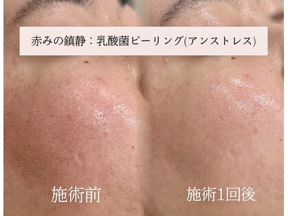 ラシュール(Rassure)の写真