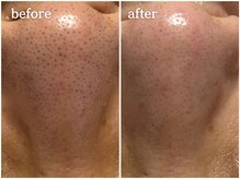 メルシア(merucia)/