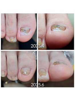 爪切り屋 足楽/