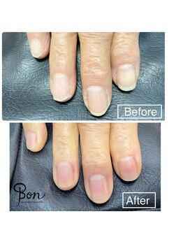 ネイルアトリエ ボン(nail atelier bon)/ネイルケア♪