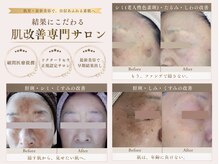 サロンドアモール(Salon de a mole)