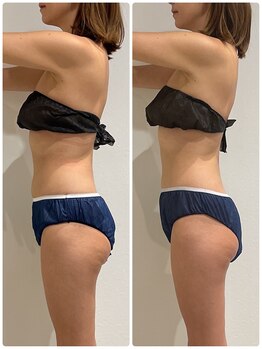 エイジングケアサロン 青山 本店/3種マシーン・90分最強痩身!