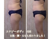 ルポーゼ(Repose)/