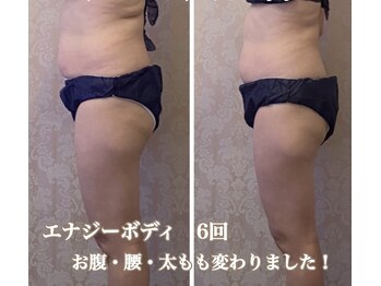 ルポーゼ(Repose)/