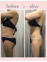 ユルリ 水戸本店(yururi)/＼＼理想の体型をゲット／／♪