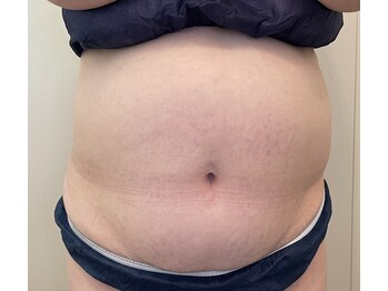 リフティングラボ(LIFTING LAB)/