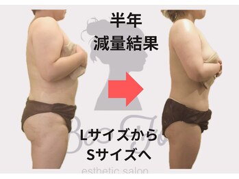 ビーフォー(be for)/10キロ減量成功！