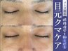 【メンズ限定】目元の疲れ、眼精疲労が気になる方!目元クマケアで疲労回復を!