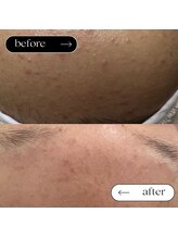 トータルビューティーサロンリア(Li'a)/ビフォー＆アフター