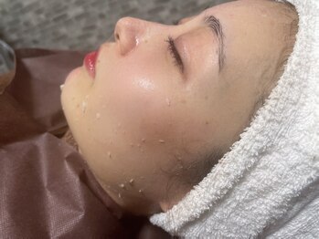 リア(Li'a)の写真/【千歳町から徒歩1分】いつものスキンケアがぐんぐん浸透！お肌に優しい低温ワックスでクリアな素肌へ♪