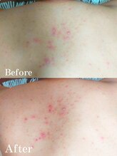 エアレ(eare)/【メンズ】背中一回の効果