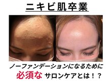【ノーファンデ肌】トラブルを根本から改善に導きます！！