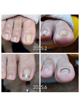 爪切り屋 足楽/