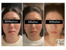 キュープ 下北沢店(Qpu)/ビフォーアフター