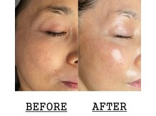 ラリマ(La-lima)の雰囲気（年齢を重ねても素肌の美しさ・輝きをアップグレードできます）