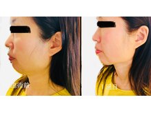 サロンモコ(Salon Moco)/