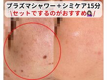 ベルファーム(Belle Femme)/大きいシミも大丈夫◎