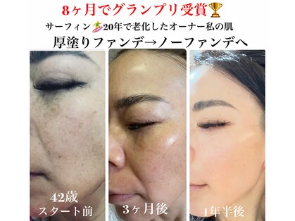 デアマリスの写真