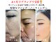 デアマリスの写真