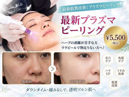 エクラ 六本木(eclat)の写真