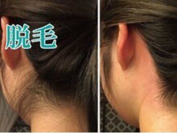 レディース ビホウ(BIHOU)/