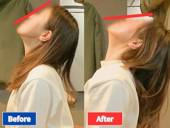 ナオル整体 仙台院(NAORU整体)/40代女性 肩こり/首こり/反り腰