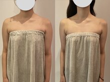 サロンリーナ 銀座店(SalonLena)/ブライダル(デコルテ)