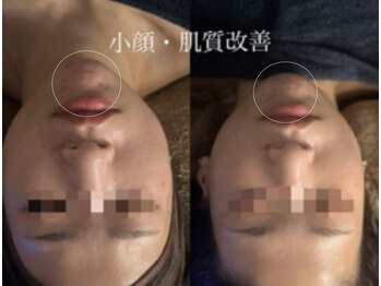 オーシャンブルーム 目黒(OceanBloom)/