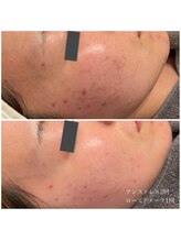 エクラ(eclat)/クリスティーナ