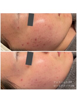 エクラ(eclat)/クリスティーナ